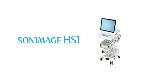 超音波診断装置　SONIMAGE HS1のイメージ