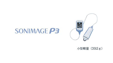 携帯型超音波装置　SONIMAGE P3のイメージ